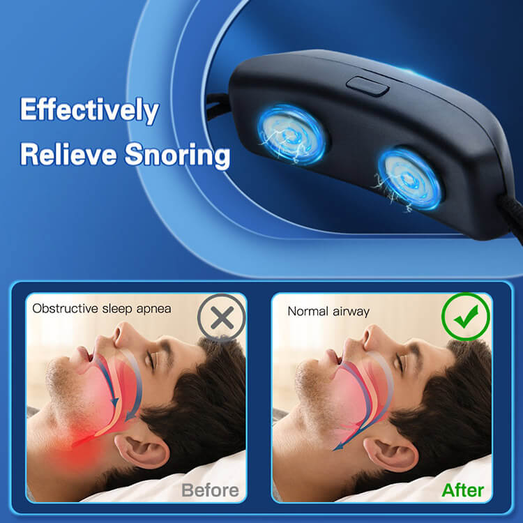 Smart Anti Snoring Device With Pulse Technology Smart Anti Snoring Device